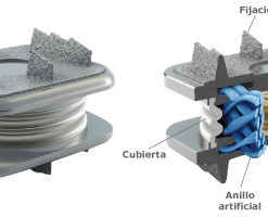 M6 Protesis de Disco Cervical en Guadalara