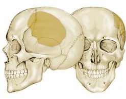 craneoplastic | producto medico para cirgias de neurologia en Guadalajara | IGEA