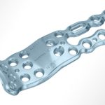 APTUS Wrist (Muñeca) | Productos Medicos para Cirugias de Trauma en Guadalajara | IGEA