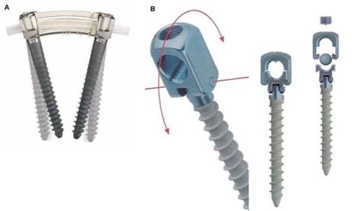 Productos y Servicios Medicos para Cirugias de Columna en Guadalajara