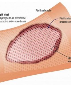 Membracel | Productos Medicos en Guadalajara para Heridas