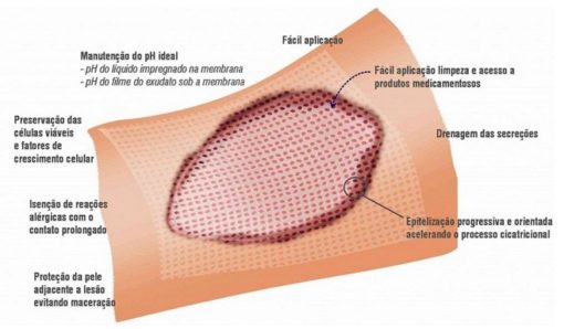 Membracel | Productos Medicos en Guadalajara para Heridas