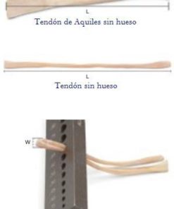 aloinjertos de tendon para injertos en guadalajara | IGEA