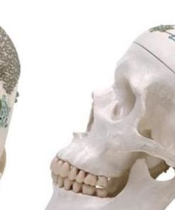 Mini placa Sistema especializado para reconstrucción de cráneo
