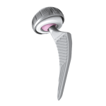 Prótesis de Cadera Amistem y Quadra | Productos y Servicios Medicos en Guadalajara | IGEA