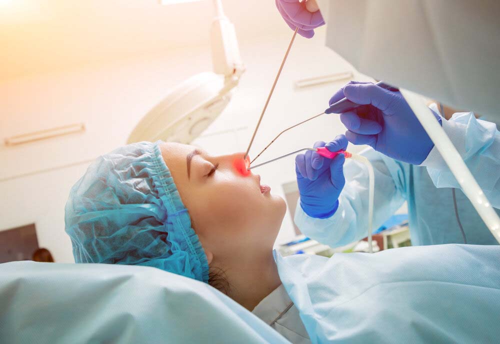 cirugia endoscopica de polipos nasales en guadalajara | IGEA