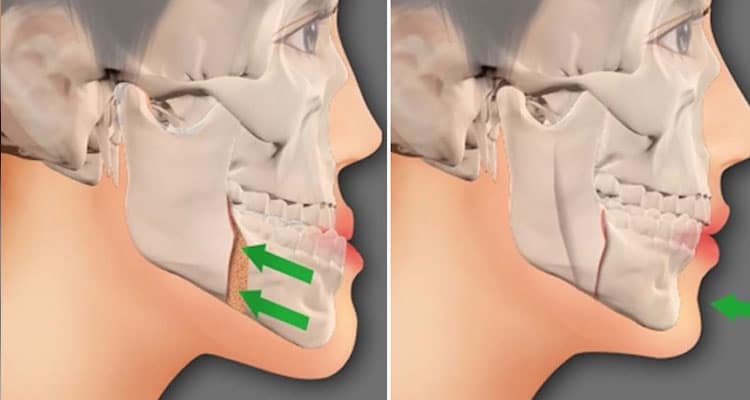 Cirugía de Traumatología Maxilofacial en Guadalajara | Servicios Medicos para cirugia de trauma