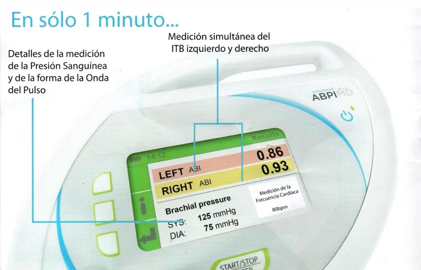 Cómo se Diagnostica la Enfermedad Arterial Periférica | Equipos Medicos para Presion Arterial en Guadalajara | IGEA