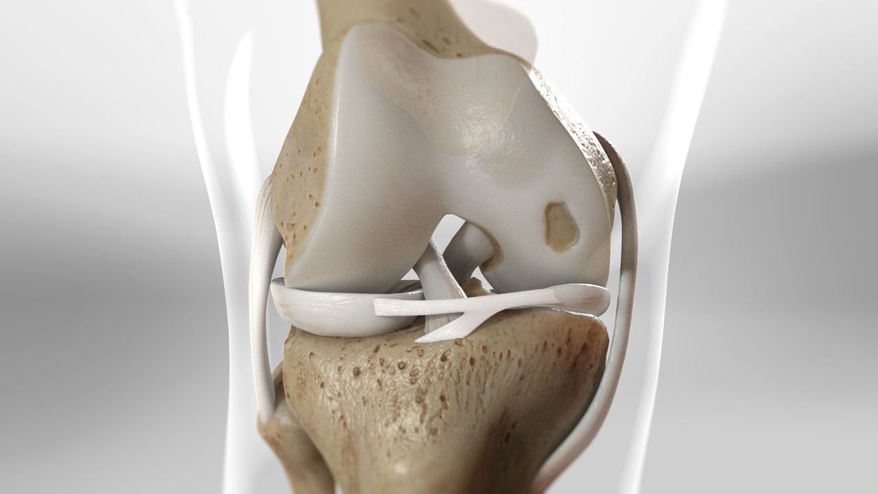 tipos de injertos oseos | reparador de cartilago articular en mexico, guadalajara, los cabos, monterrey y cancun