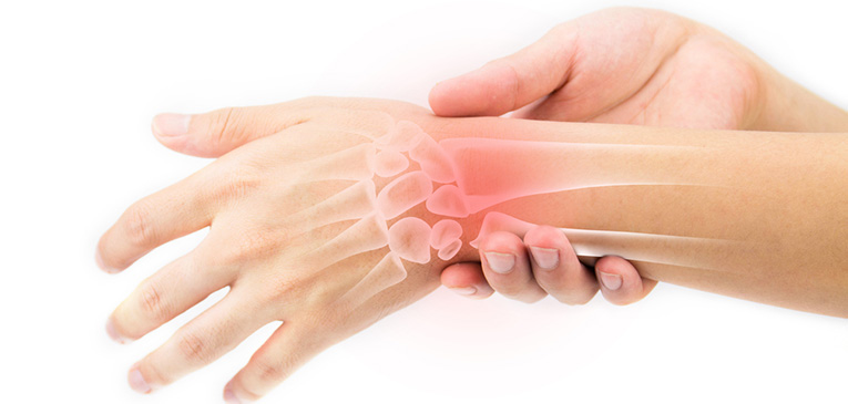 Tipos de cirugía de mano mas comunes | Productos y Servicos Medicos de Trauma y Ortopedia en Guadalajara