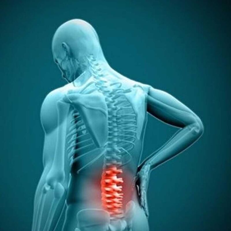 tipos de lumbago | productos y servicios medicos en guadalajara, monterrey y cancun