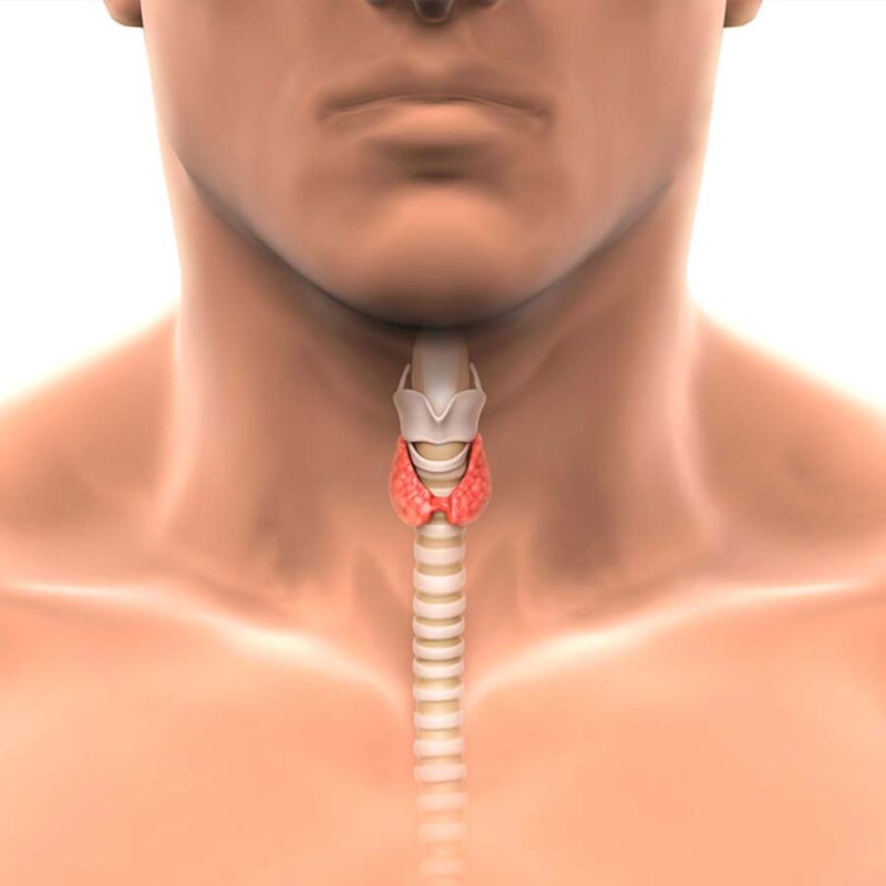 padecimientos en la tiroides | medicos especialistas en cabeza y cuello en mexico | IGEA guadalajara