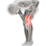 Cirugías Artroscópicas de Hombro, Rodilla, Codo, Tobillo en Mexico | equipo VAPR3