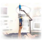 Spider Smith & Nephew mexico | posicionador quirurgico de muñeca | soluciones quirurgicas para trauma en guadalajara