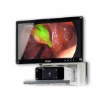 Torre de Endoscopia 4K Stryker | Tecnología de Última Generación para Cirugías de Mínima Invasión en Guadalajara