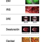 novedades de la camara stryker | sistemas endoscopicos en guadalajara