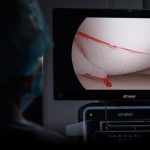 ¿Por qué la Cirugía Endoscópica es Mejor? | sitemas de endoscopia en guadalajara