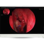 Camara para Endoscopia Stryker 1588 Mexico | renta y venta de equipo medico en guadalajara