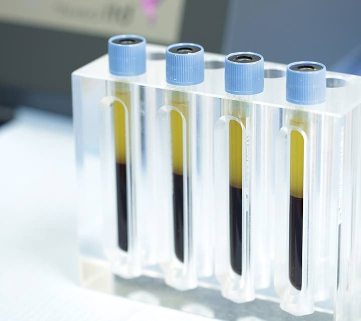 Procedimientos Médicos que Usan el Horno PlasmaTerm H