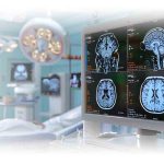 en que tipos de cirugías se usa el set de craneotomia | neurocirujanos en mexico