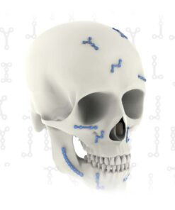 Set Maxilofacial Synthes mexico | Soluciones medico quirurgicas para Cirugías Faciales y Reconstructivas en Guadalajara | IGEA