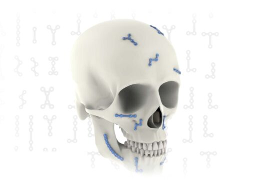Set Maxilofacial Synthes mexico | Soluciones medico quirurgicas para Cirugías Faciales y Reconstructivas en Guadalajara | IGEA