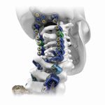 Stryker TPS Universal Driver | Fijacionde placa cervical en Mexico | IGEA