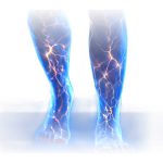 Manejo Postquirúrgico con Cavilon 3M Mexico | IGEA SOluciones medicas para el tratamiento de heridas en guadalajara