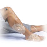 adaptador en y Genadyne | Soluciones para tratamientos de lesiones Complejas