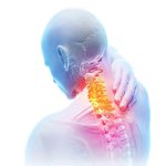 ¿Cuáles son los tipos de retractores cervicales? | soluciones de columna en mexico | IGEA