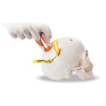 cranial loop mexico | soluciones para neurocirugia en mexico | IGEA