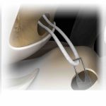 ProCinch RT Stryker | soluciones para ortopedia en mexico | IGEA
