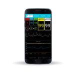 Monitor de Profundidad Anestésica CONOX | Soluciones Médico Quirúrgicas en México | IGEA