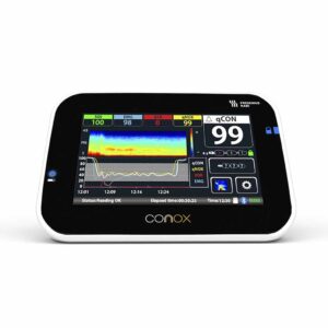Monitor de Profundidad Anestésica CONOX | Soluciones para Otorrinolaringología en México | IGEA