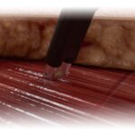 Sellador Aquamantys Bipolar 6.0 | Soluciones para Otorrinolaringología en México | IGEA