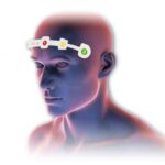 Sensor frontal CONOX | Soluciones para Otorrinolaringología en México | IGEA